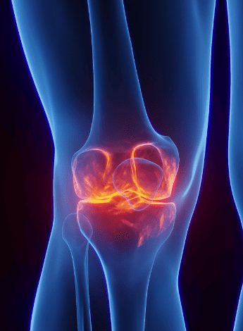 Radiographic image of a knee